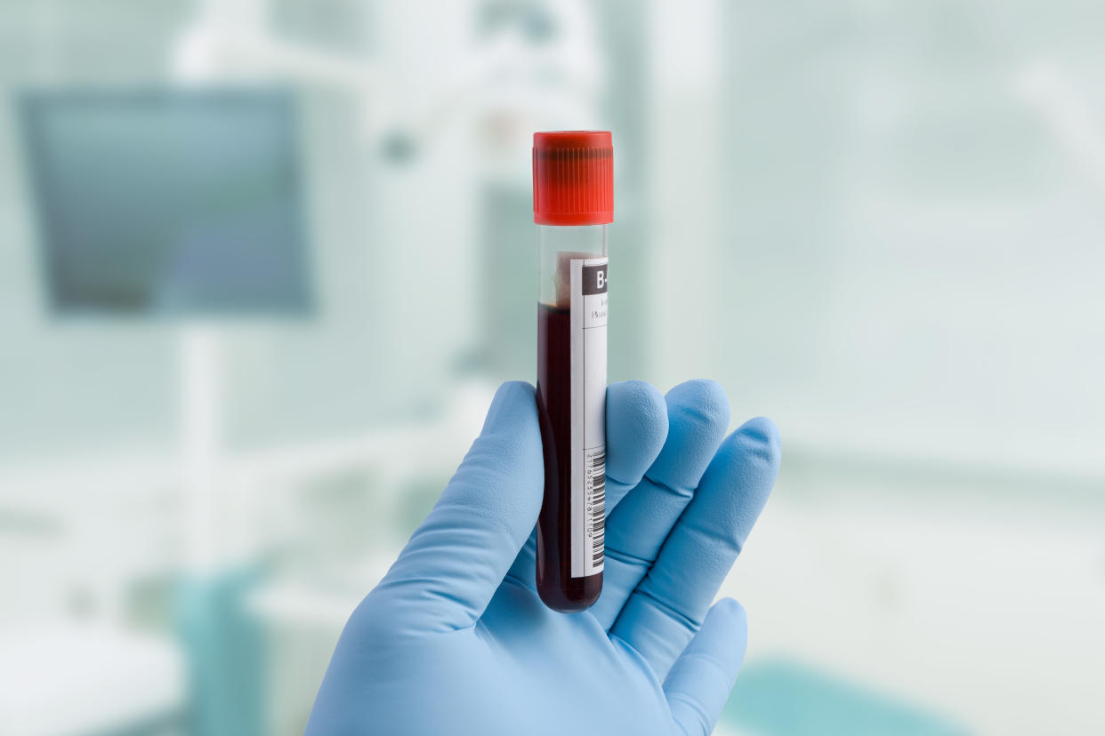 A surgical-gloved hand holds a red-topped glass vial that appears to be filled with blood.