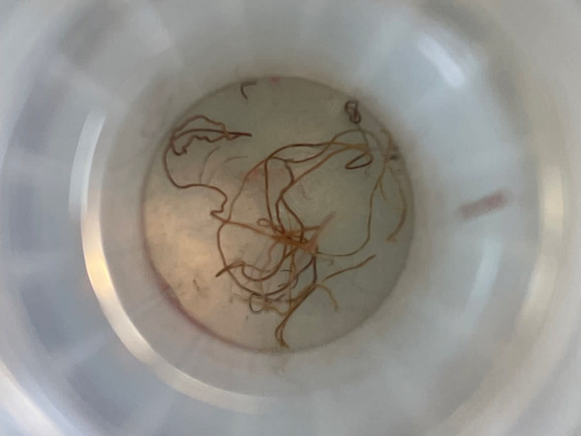 This photo of brain worms in a container at a research lab at Acadia University is what a parasite in a moose's body could look like. (Submitted by Willow Bennett - image credit)