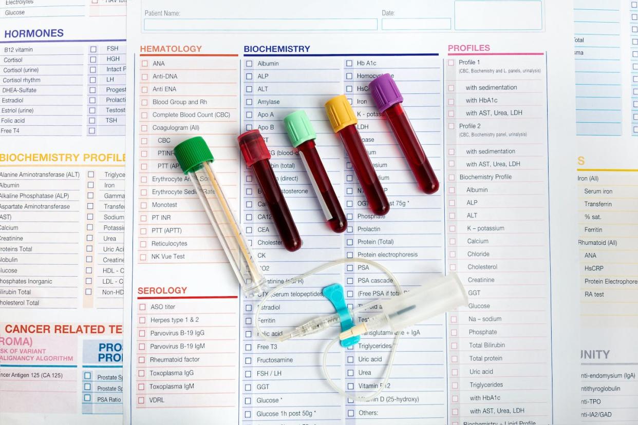 From CBC to CMP and beyond, blood test panels provide essential information to health practitioners. <a href="https://www.gettyimages.com/detail/photo/workplace-of-laboratory-with-blood-tubes-samples-royalty-free-image/1389684965" rel="nofollow noopener" target="_blank" data-ylk="slk:angelp/iStock via Getty Images Plus;elm:context_link;itc:0;sec:content-canvas" class="link ">angelp/iStock via Getty Images Plus</a>