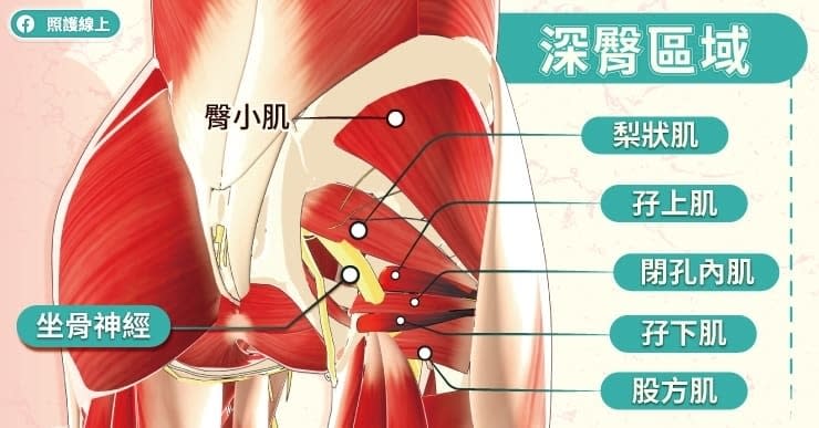 深臀症候群的發生原因