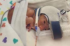 Ellieana Meixueiro lies in a neonatal intensive care unit, hooked up to a CPAP machine that's helped keep her lungs open since she was born prematurely last month at the University of Kansas Medical Center in Kansas City, Kan. Her family is asking for financial help on the GoFundMe website.