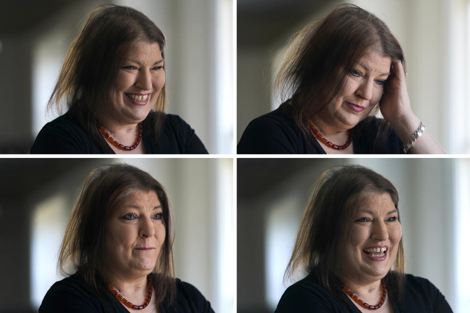 In this combination of photos, Kari Wegg's face shows a range of emotions as she recounts her COVID-19 ordeal that resulted in a double-lung transplant during an interview in her home in Westfield, Ind., on Sunday, March 21, 2021. “I started thinking a lot about death and I’m not prepared for that,” she says. “Rodney always told me not to worry, that he’s got it, that he’s going to take care of me, that he got me this far and everything is going to be OK. But I worry that it’s not.” (AP Photo/Charles Rex Arbogast)