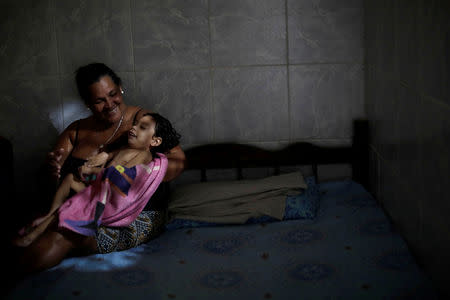 Silvina da Silva poses with her two-year-old granddaughter Ana Sophia, who was born with microcephaly, at their house in Olinda, Brazil, August 7, 2018. Ana Sophia's mother Gabriela had planned to finish high school and study physical therapy. Now, she spends her days caring for her child. Her husband left shortly after Ana Sophia's birth. He could not accept their child's condition, Gabriela says, and does not pay child support. "I went into depression and my family helped me," she said. "If it was not for them, I would have gone crazy." Today, some relatives give moral support and Ana Sophia's paternal grandmother helps with her day-to-day care. REUTERS/Ueslei Marcelino/Files