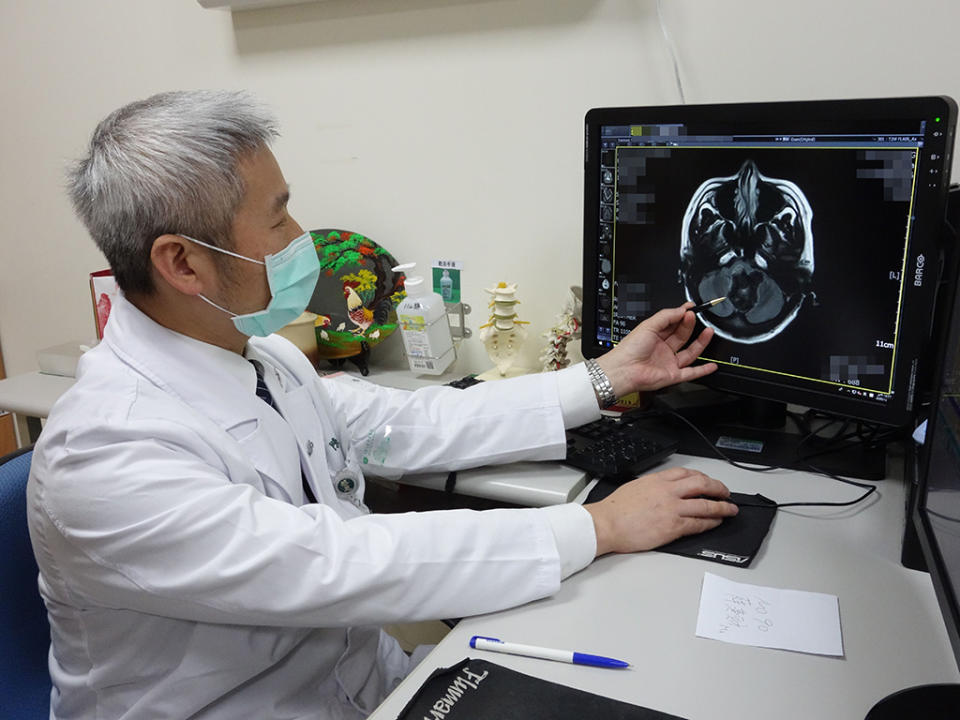 大林慈濟醫院陳金城副院長做腦部手術後，立即解除多年的疼痛折磨。