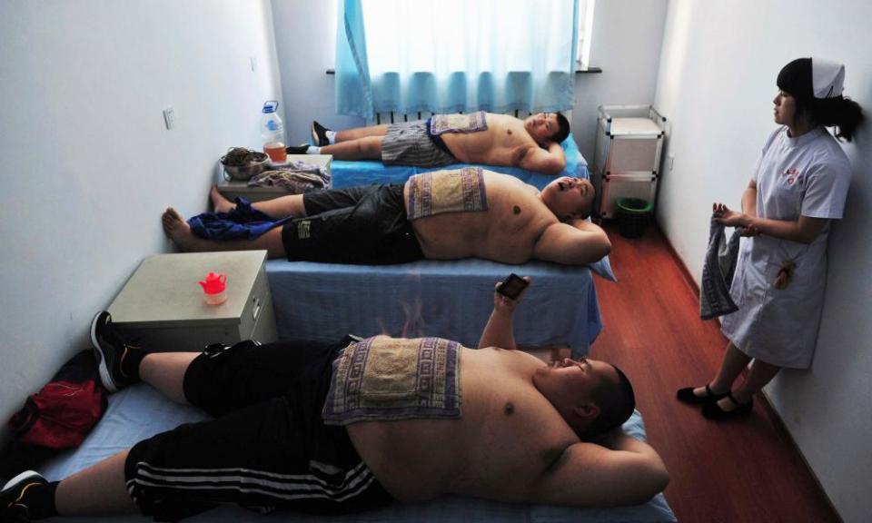 Patients undergo fire treatment, a traditional Chinese remedy for obesity, at a weight loss centre in Changchun.
