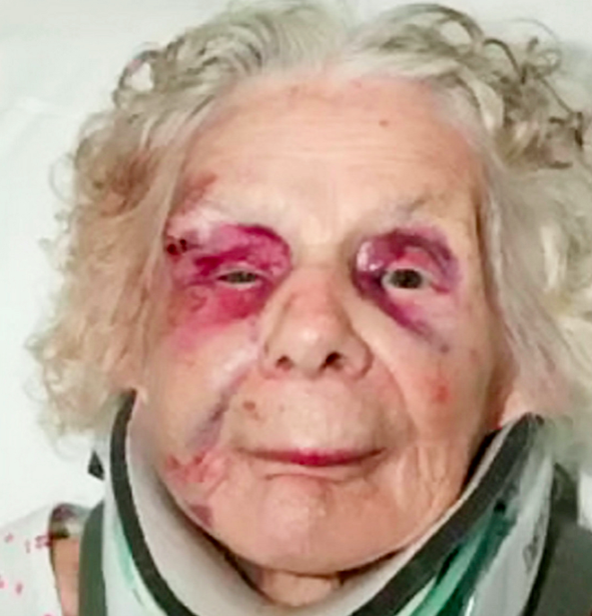 <em>Holocaust survivor Zofija Kaczan was battered from behind and knocked to the ground (SWNS)</em>