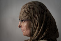 <p>Ruqayya Parveen, a 26-year-old Pakistani woman, poses for a photograph in Karachi, Pakistan. Parveen’s husband dumped a jug of acid on her and her children when they were sleeping, March 6, 2015. She said many in her community shun her, not only because of her appearance, but because they also assumed she did something to violate her family’s honor that must have provoked the attack. Pakistan is celebrating International Woman’s Day. (AP Photo/Shakil Adil) </p>