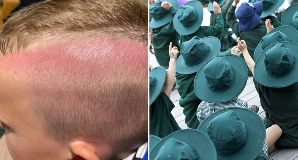 a little boy with a sunburned head (left) and school children wearing hates (right)