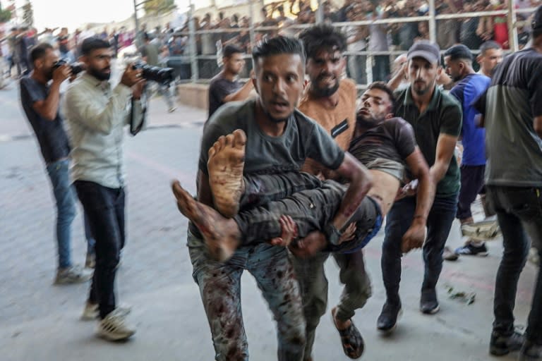 A man wounded during Israeli bombardment is carried to the emergency ward of Nassr hospital in Khan Yunis in the southern Gaza Strip on July 9, 2024 (Bashar TALEB)