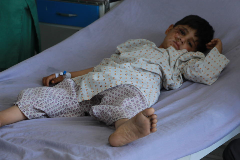 An Afghan boy is treated at a hospital after being injured during fighting between Taliban and Afghan security forces in Kunduz city, north of Kabul, Afghanistan, Thursday, June 24, 2021. Taliban gains in north Afghanistan, the traditional stronghold of the country's minority ethnic groups who drove the insurgent force from power nearly 20 years ago, has driven a worried government to resurrect militias whose histories have been characterized by chaos and widespread killing. (AP Photo/Samiullah Quraishi)