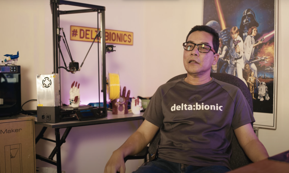 A man by the name of Pak Su in his home, with a 3D printing device he uses to print 3D prosthetics.