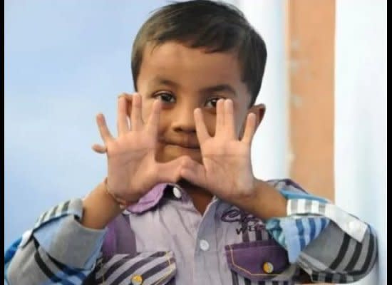 Arpan Saxena, pictured here at 4, has 13 fingers and 12 toes, some of which are fused together. 