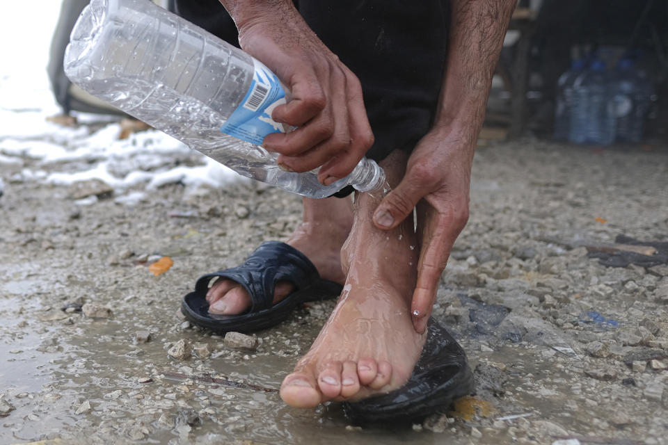 A migrant washes his feet during a snowfall at the Lipa camp, outside Bihac, Bosnia, Friday, Jan. 8, 2021. A fresh spate of snowy and very cold winter weather on has brought more misery for hundreds of migrants who have been stuck for days in a burnt out camp in northwest Bosnia waiting for heating and other facilities. (AP Photo/Kemal Softic)
