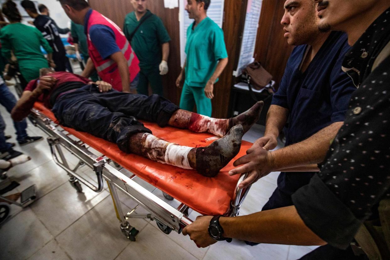 People who were injured during the ongoing Turkish offensive against Kurdish-controlled areas of northeastern Syria receive treatment at a hospital in Tal Tamr, near the Syrian Kurdish town of Ras al-Ain: Photo by DELIL SOULEIMAN/AFP via Getty Images