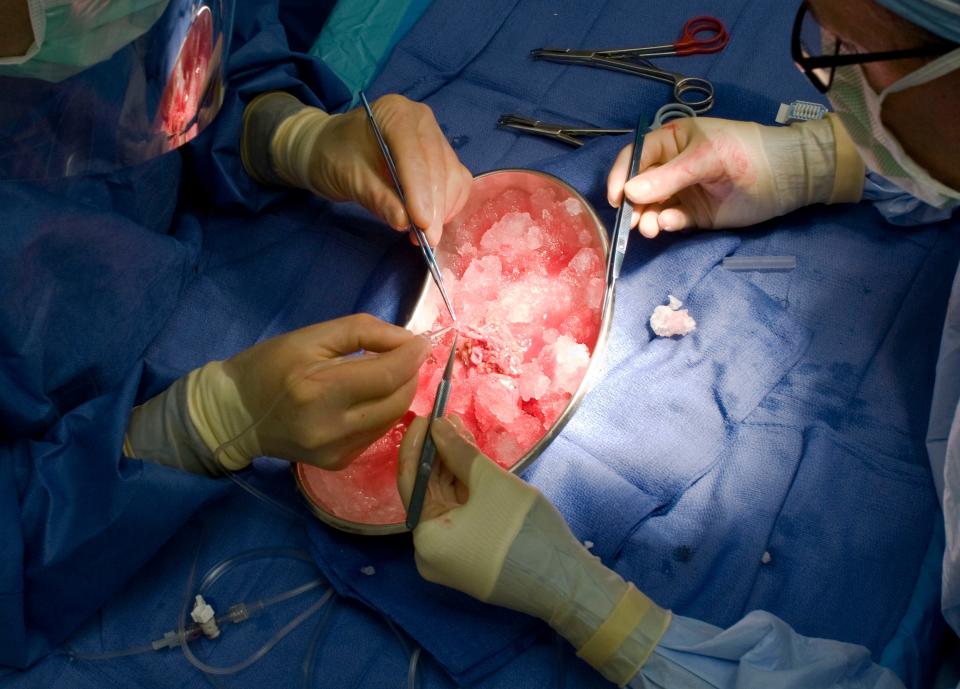 Doctors work on a kidney recently removed from a donor at a hospital in Portland, Ore., on Oct. 4, 2010.