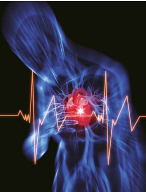 心肌梗塞好發於有心血管疾病的中老年人。