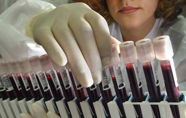 Scientists believe red blood cells' flexibility contributes to their ability to circulate for an average of 120 days. Above, viles of blood are prepared to be screened at the American Red Cross National Testing Laboratory in San Diego.