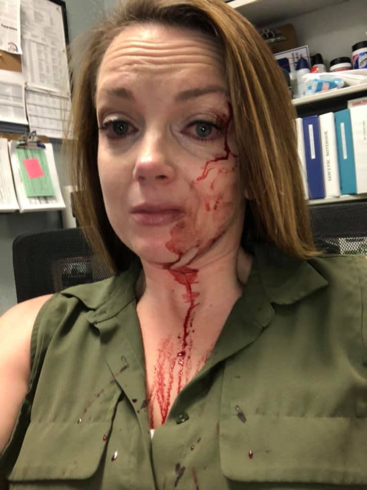 Pictured is Samantha McCune-Clarke with blood running down her face from a cut on her eyebrow. 