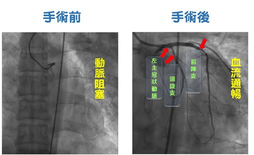 陳業鵬也提醒年輕族群，心血管疾病不再只是發生在老人家。（圖／中國醫藥大學新竹附設醫院提供）