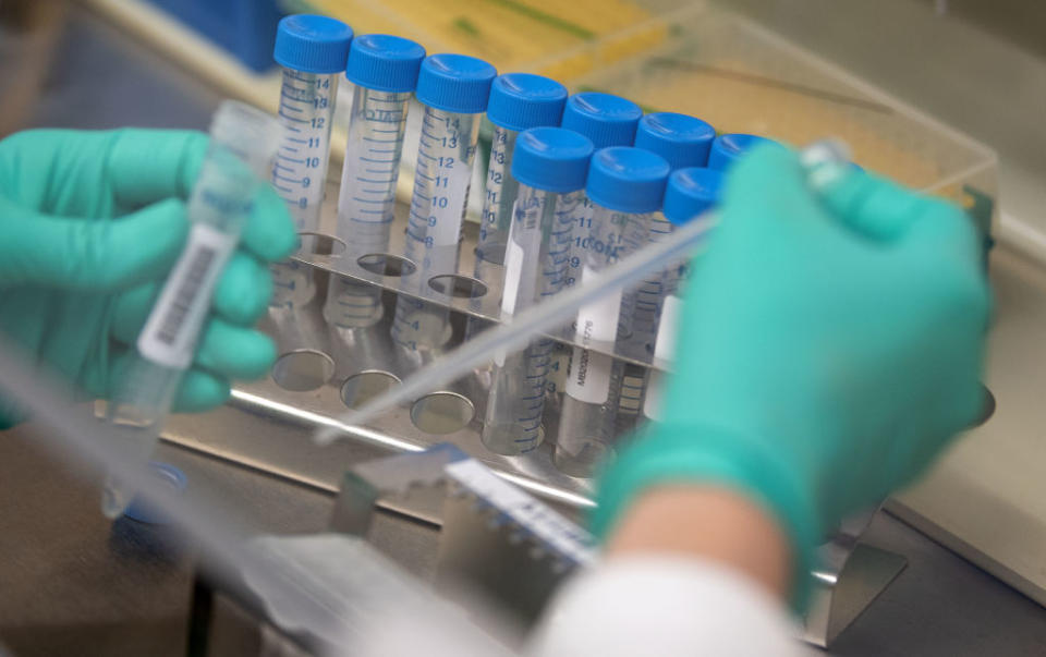 18 June 2020, Baden-Wuerttemberg, Stuttgart: A staff member of the Baden-WÃ¼rttemberg State Health Authority is pipetting corona samples during an experiment carried out by Baden-WÃ¼rttemberg's Minister President Kretschmann. The State Health Office is the specialist control centre for the public health service in Baden-WÃ¼rttemberg. This is where the corona crisis comes together. Photo: Marijan Murat/dpa (Photo by Marijan Murat/picture alliance via Getty Images)