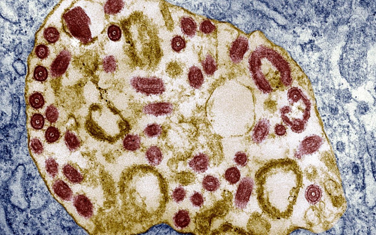 Electron Micrograph Of The Marburg Virus - BSIP/UIG Via Getty Images