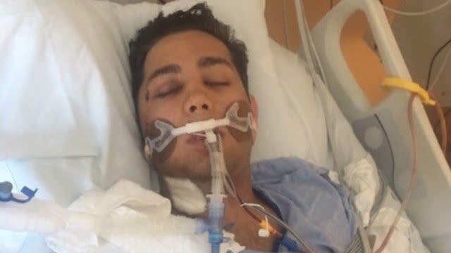 Warriors fan Salvator Bimbo, 21, says a Cavaliers fan pushed him from an Oracle Arena ledge at the end of Game 7. (Snapchat)