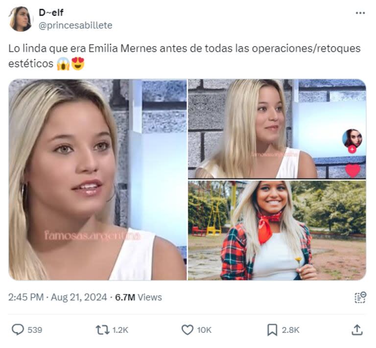 Las fotos del antes y después de Emilia Mernes que generaron furor en las redes sociales (Captura: X)