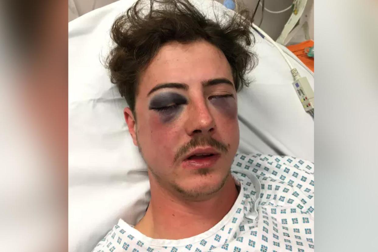 Police say Michael Voller was attacked by a fellow Spurs fan