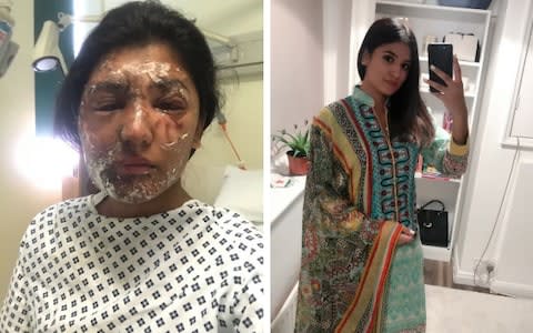 Resham Khan faced an acid attack on her 21st birthday - Credit: Resham Khan