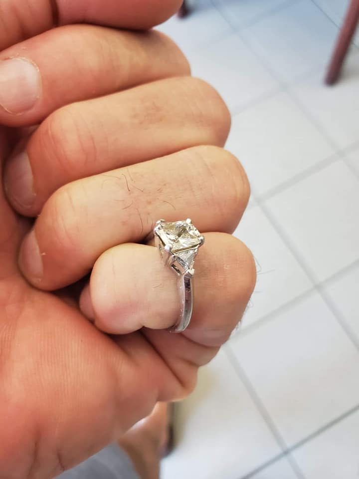 A woman shows off her engagement ring after having it surgically removed from her intestine.