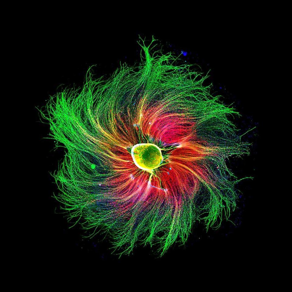 Sensory neuron from an embryonic rat<span class="copyright">Paula Diaz—Courtesy of Nikon Small World</span>