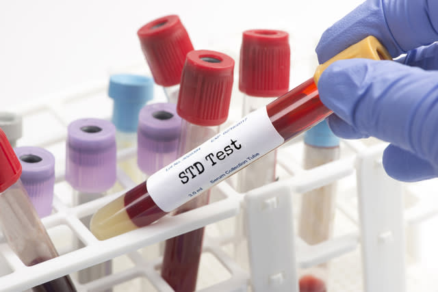 STD Testing Technology