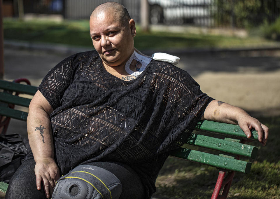 Cecilia Heyder, a Chilean activist for the right to a dignified death and who suffers from metastatic cancer, lupus and a blood disorder, sits during an interview with The Associated Press at a park in Santiago, Chile on April 15, 2021. (Esteban Felix / AP file)