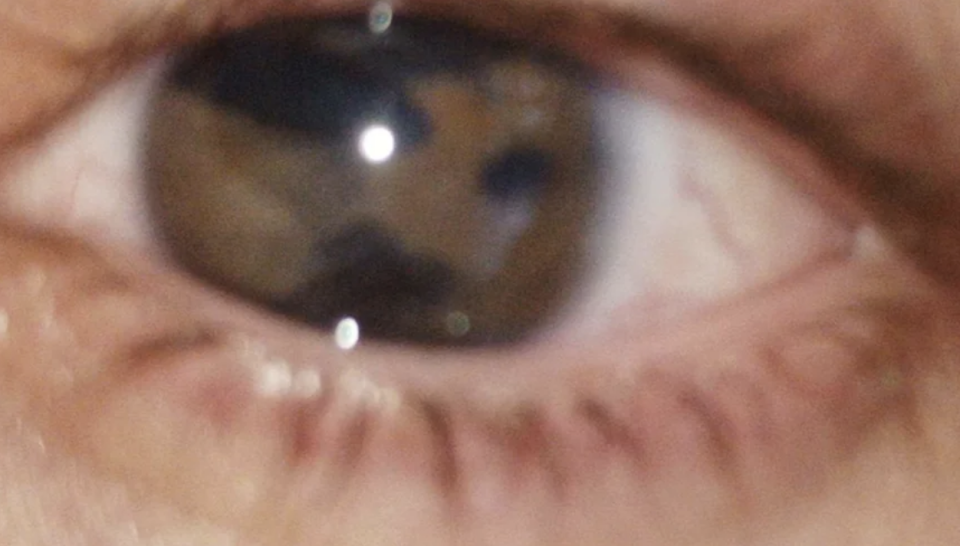 closeup of 3 pupils