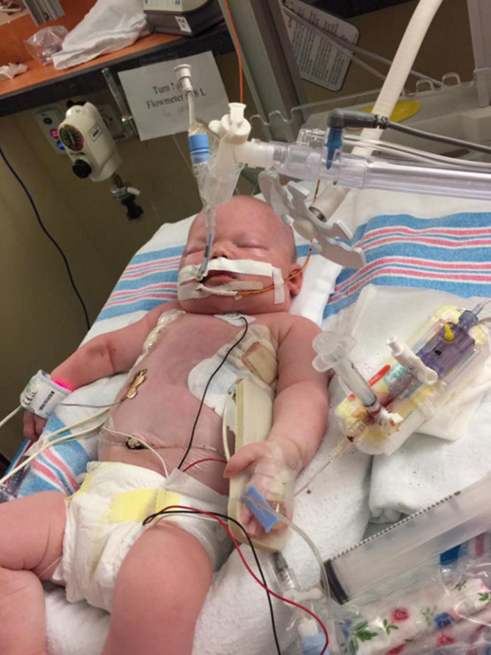 Baby Aliza Rose Friend contracted neonatal herpes. Source: Kennedy News and Media