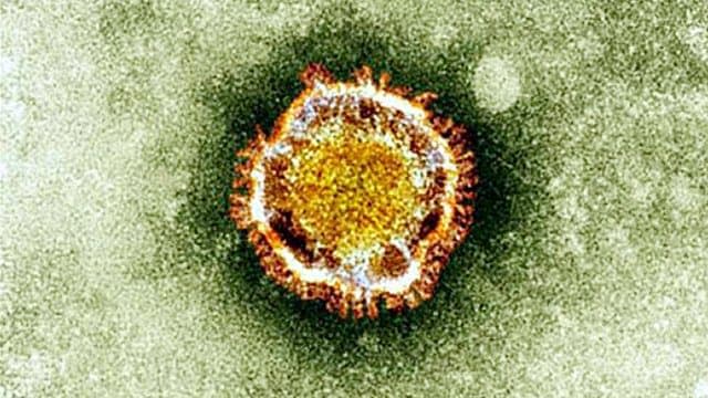 Le coronavirus vu au microscope - AFP