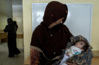 A mother holds her malnourished baby at the malnutrition ward of the Indira Gandhi hospital in Kabul, Afghanistan, Wednesday, May 18, 2022. Some 1.1 million Afghan children under the age of five will face malnutrition by the end of the year. , as hospitals wards are already packed with sick children . (AP Photo/Ebrahim Noroozi)
