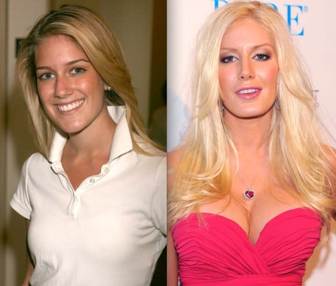 Heidi Montag