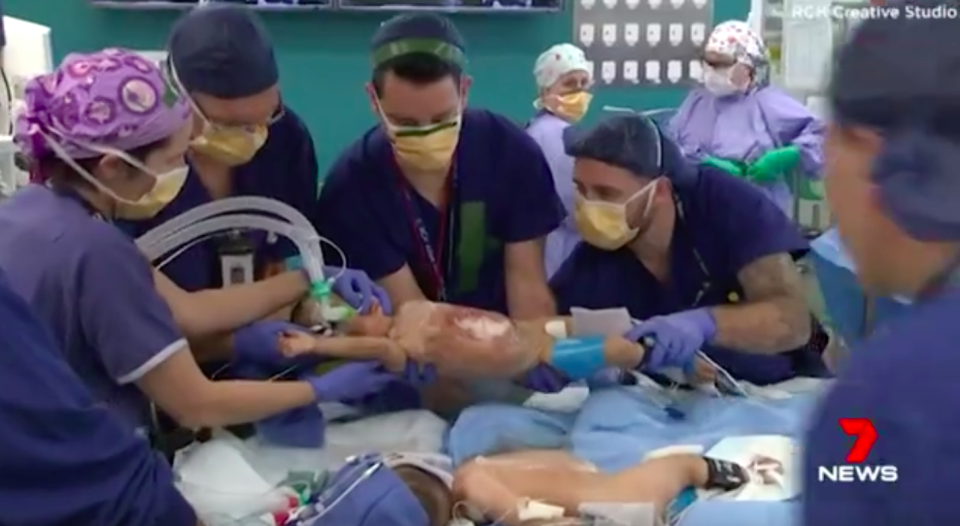 Conjoined twins Nima and Dawa were separated during a six-hour surgery last Friday. Source: 7 News