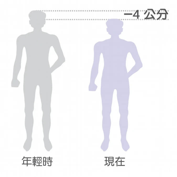 4個指標簡單測骨鬆