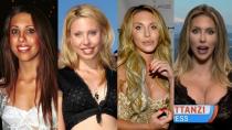 Changing face of Chloe Lattanzi