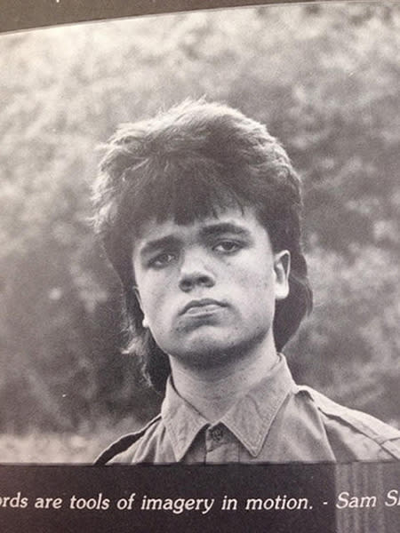 <p>He may be the coolest cast member on 'Game of Thrones' but this retro hair pic of the Tyrion Lannister actor is up there with the best throwback snaps we've ever seen.</p>