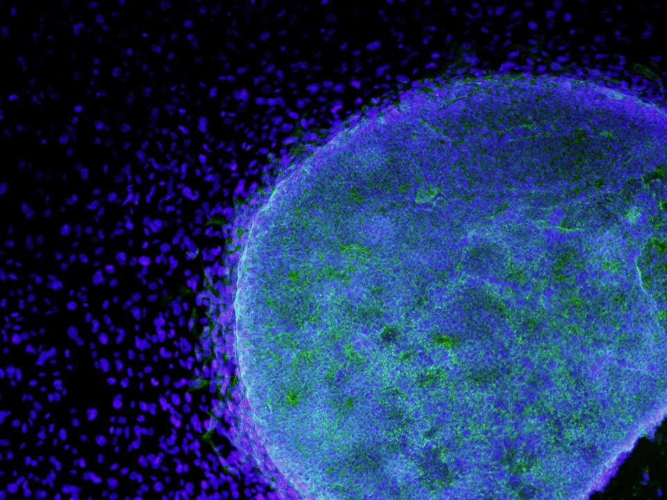 A picture shows human embryonic stem cells growing on fibroblasts.