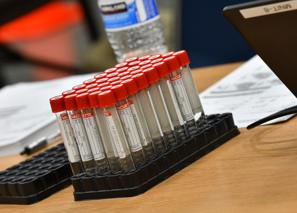 Empty vials are ready for testing procedures during a Minnesota Department of Health COVID-19 testing clinic Thursday, Oct. 15, 2020, at the River's Edge Convention Center in St. Cloud. 