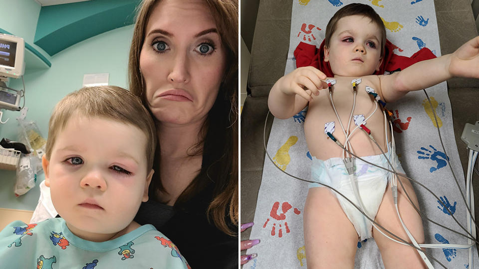 Eden Strong explained her son Baylor had "severe cellulitis", after her squirted himself in the eye with a bath toy. Source: Facebook/Eden Strong - No Shame