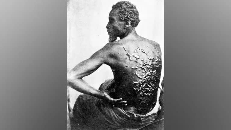 Aunque su piel había sido desgarrada numerosas veces por los latigazos y había cicatrizado, Gordon, un hombre esclavizado que había logrado escapar, posó desafiante para un retrato en 1863