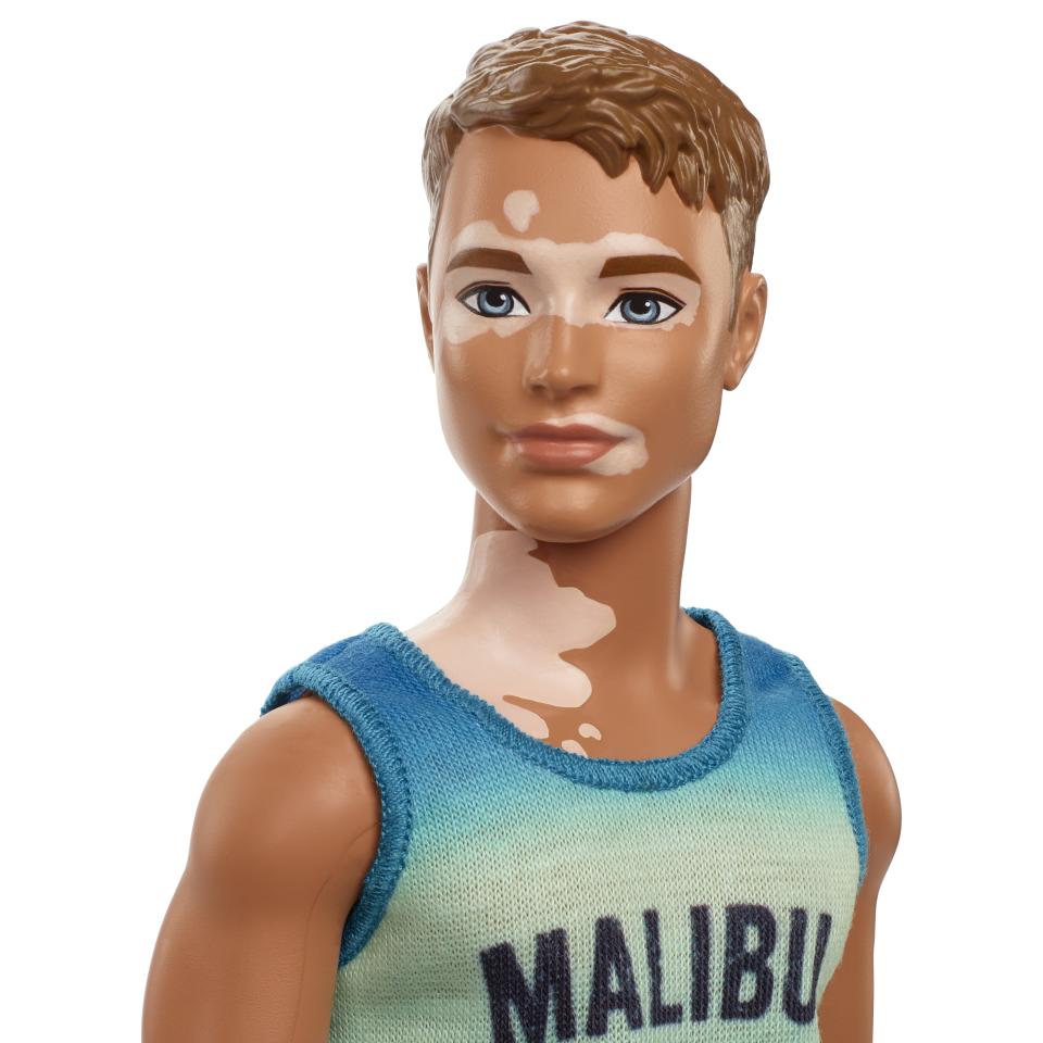 Barbie also announced the release of a Ken doll with vitiligo. (Photo: Mattel)