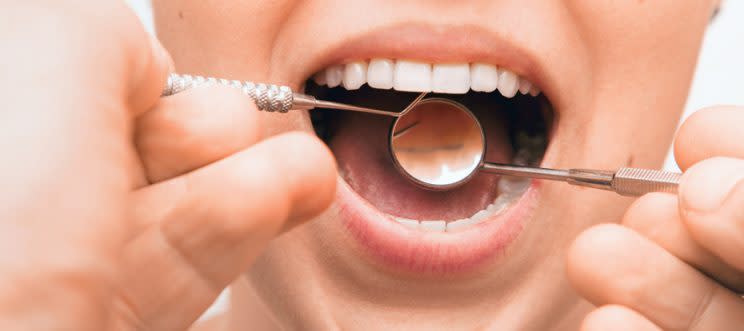 La calidad de tu dieta tendría que ver con el estado de tus dientes y encías. – Foto: AGEphotography/Getty Images