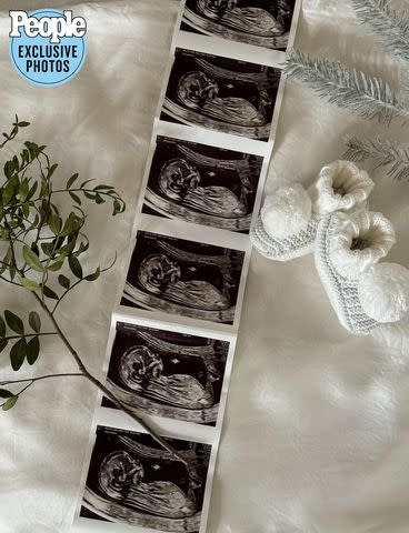 <p>emily-miller-123123</p> Emily Miller and Cam Holmes' baby's sonogram.