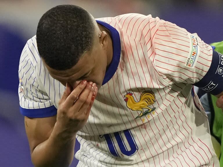 Kylian Mbappe of France holds his nose after suffering an injury during a Group D match between Austria and France at the Euro 2024 soccer tournament in Duesseldorf, Germany, Monday, June 17, 2024. (AP Photo/Martin Meissner)